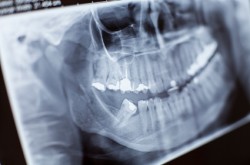 X-ray Close-up