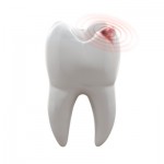 Carie Dentale e Infezioni della Polpa Dentale
