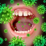 Le Infezioni Odontogene Orofacciali