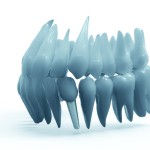 Innovazione in Implantologia Dentale con l'Osseodensificazione